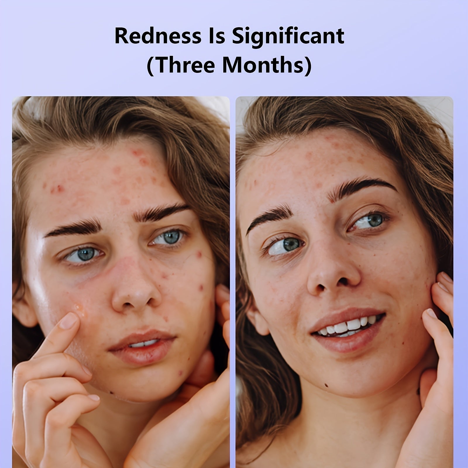 FDA Cleared LED Red Light Relax Mask, 630 Nm And 830 Nm Wavelength LED Home Light Relax Device, Electric Beauty Mask Device, Facial Skin Care Device