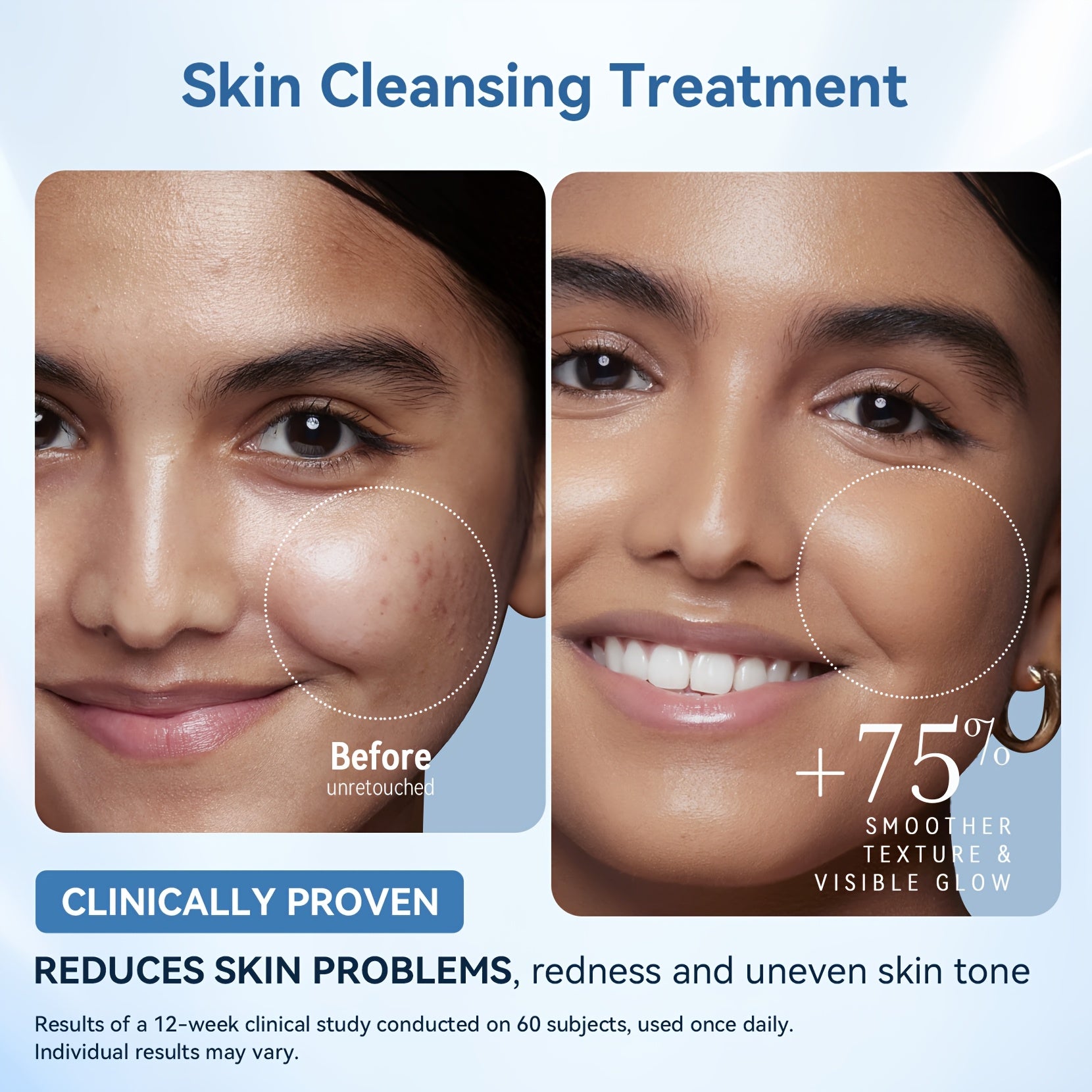 FDA Cleared LED Red Light Mask Skin Care, Three-In-One Fusion LED Lamp Beads, Infrared LED Mask - Home Wavelength, Improve Dullness, Sensitivity And Easily Create Advanced Skin Care, Home Portable Beauty Instrument, Home SPA